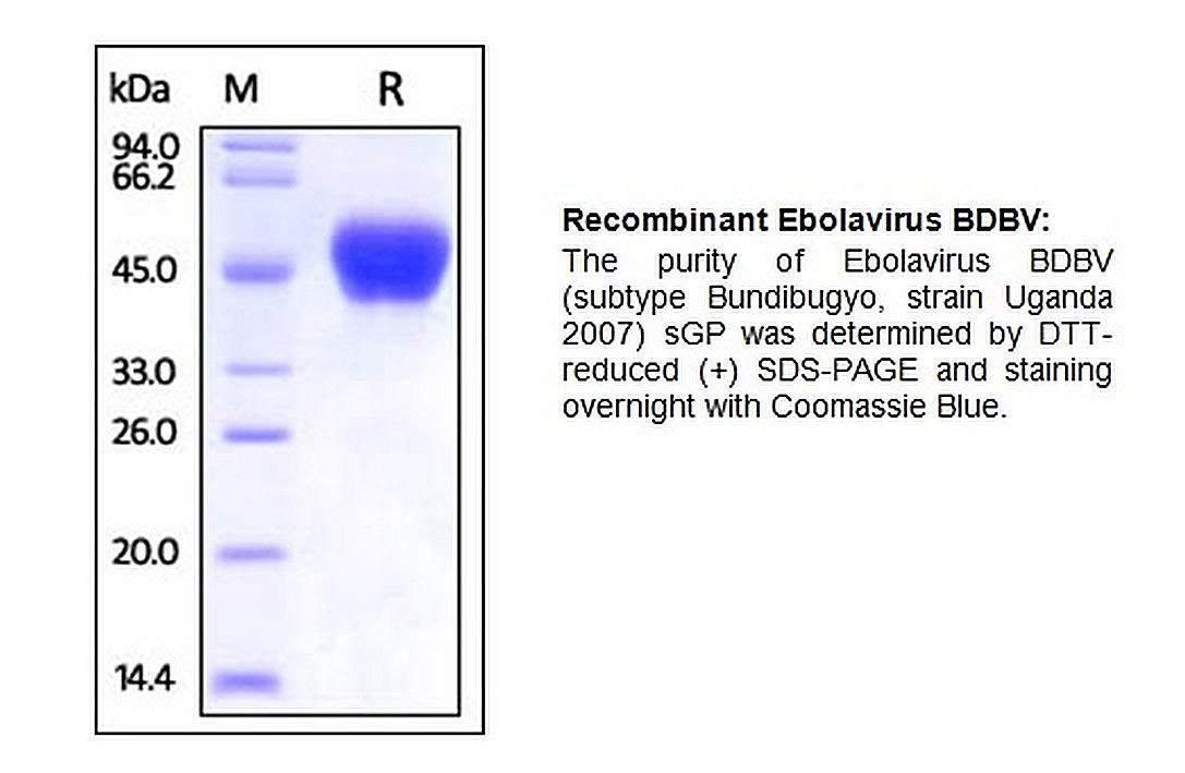 P1059-10 - Size : 10 micrograms - Human CellExp Recombinant Ebolavirus BDBV Small/secreted Glycoprotein (sGP), BioVision Inc - Each (10micrograms)