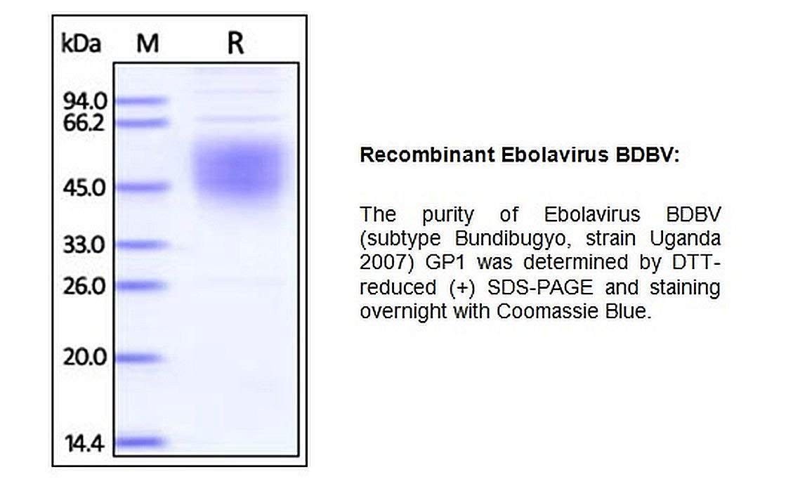 P1061-50 - Size : 50 micrograms - Human CellExp Recombinant Ebolavirus BDBV Envelope Glycoprotein 1 (GP1), BioVision Inc - Each (50micrograms)